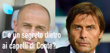 Conte Trapianto Capelli