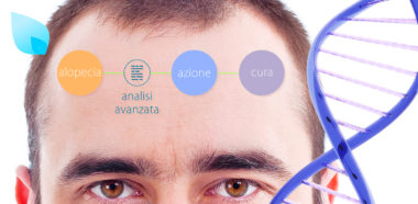 Diagnosi Calvizie HairClinic