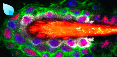 Ricerca Cellule Staminali e Calvizie