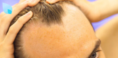 Finasteride Propecia