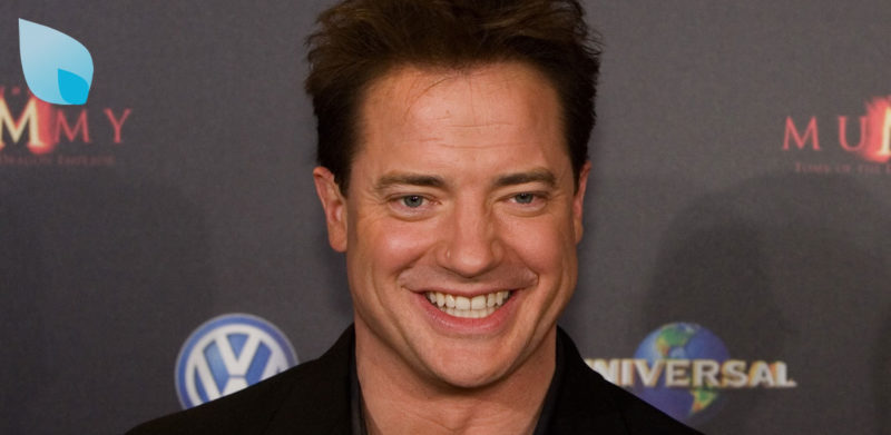 Brendan Fraser Trapianto Capelli VIP